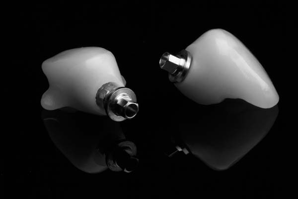 How To Protect Your Dental Implants