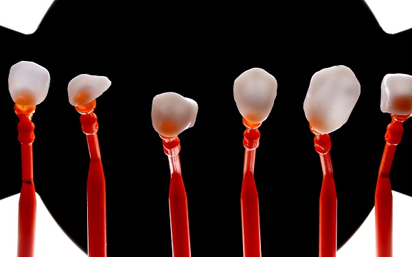 Adjusting To Your New Life With Dental Veneers